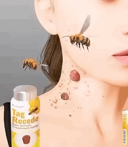 Spray Natural Anti-verrugas